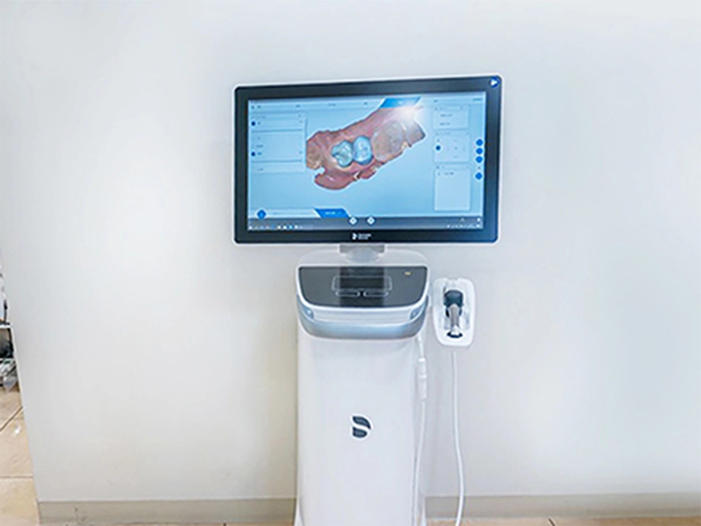 CEREC（セレック）を導入しました