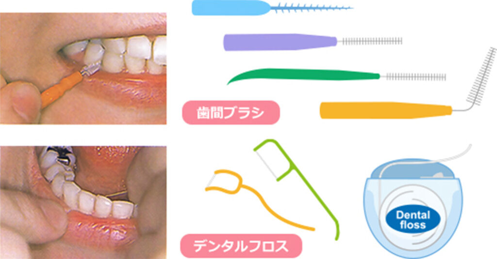歯ブラシの補助
